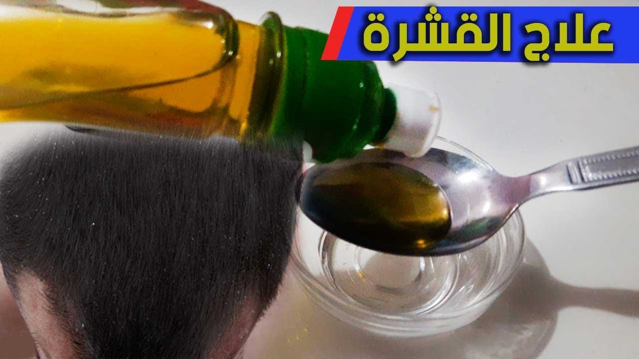 علاج القشره من اول مره , كثيرا منا يعاني منه