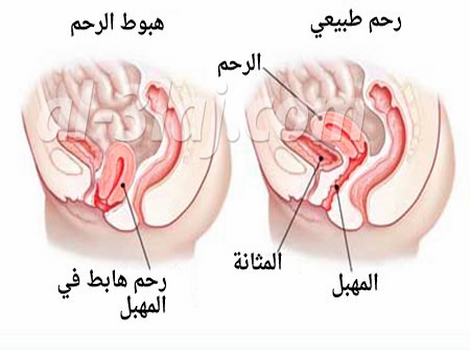 اعراض الاجهاض المبكر - احذري هذه العلامات فانت في مرحلة الاجهاض 668 9