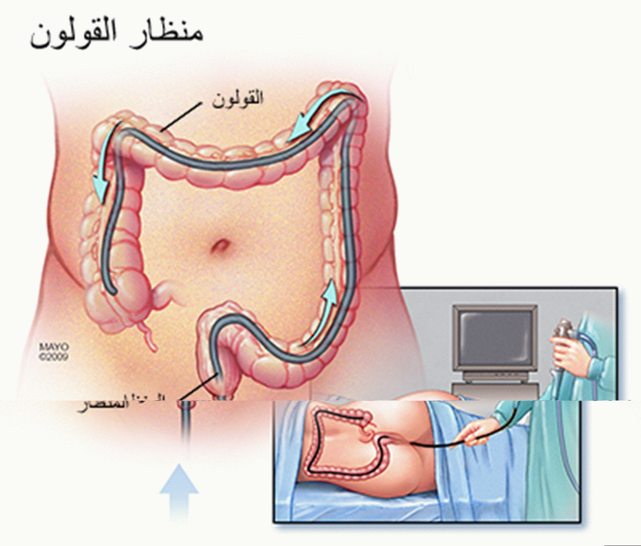 هل منظار القولون مؤلم , كل الامراض مؤلمه