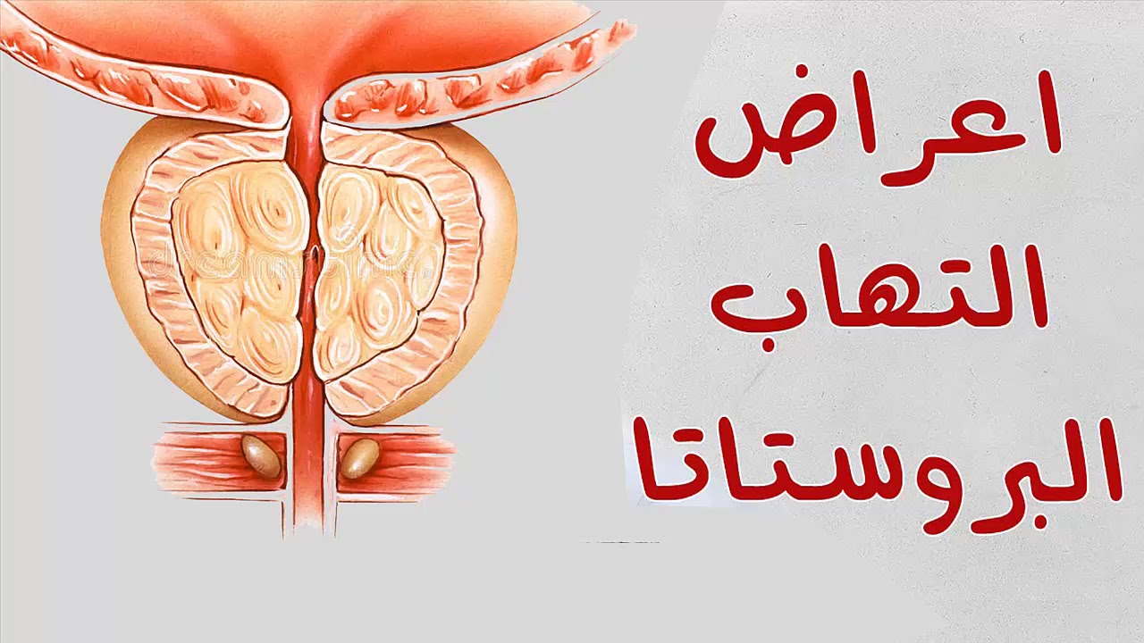 اعراض التهاب البروستاتا المزمن , يؤلم كل الرجال