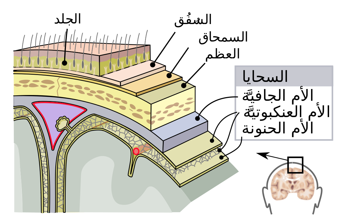 ماهو مرض التهاب السحايا , التهاب السحايا واعراضه واسبابه وكيفيه علاجه