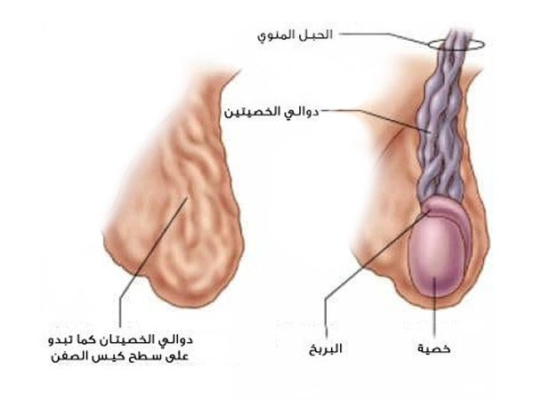 شكل دوالي الخصية بالصور - تعرف على مرض دوالي الخصية للرجال 4463 2