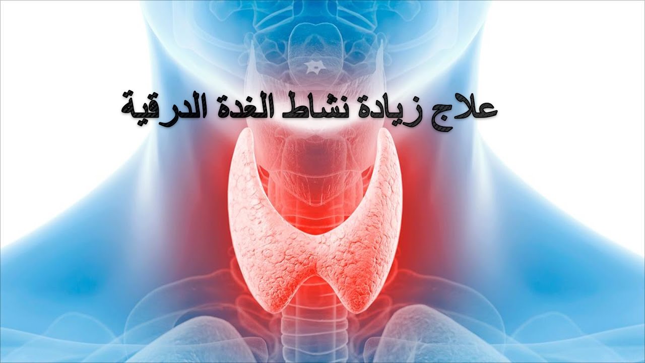 علاج فرط الغدة الدرقية - اسرع علاج للغذه الدرقية 1765