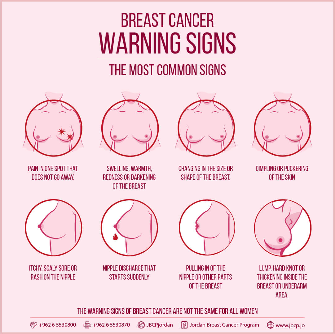 اعراض سرطان الثدي عند الفتيات بالصور - سرطان الثدي و اعراضه 2008 2
