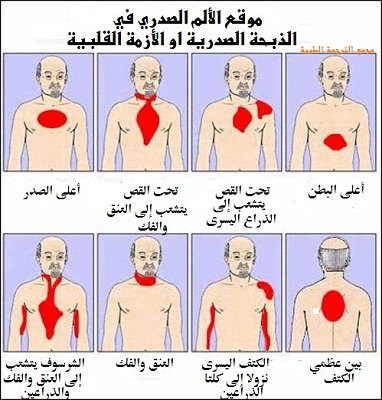 اعراض امراض القلب - الاشياء المحظوره على مريض القلب 2296 8