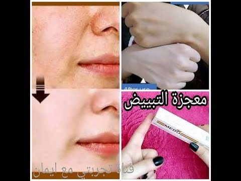 كريم يبيض الوجه - اروع انواع الكريمات 230 12