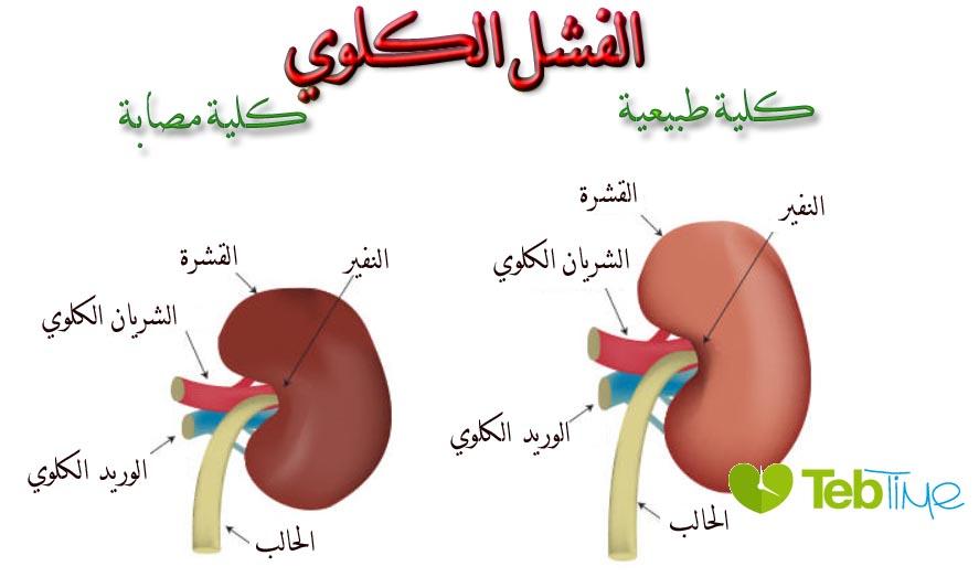 اعراض القصور الكلوي - تعرف على مسببات واعراض 4257 2