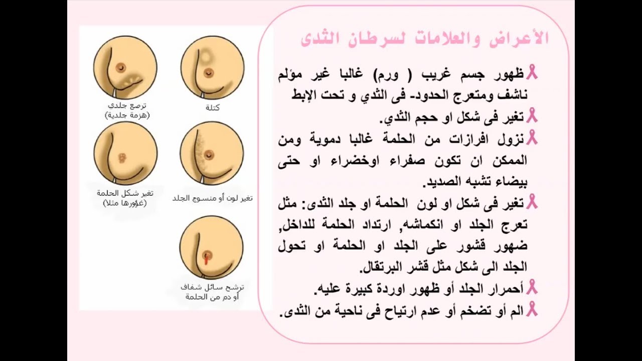 من اعراض سرطان الثدي - اصعب مرض للسيدات 4445