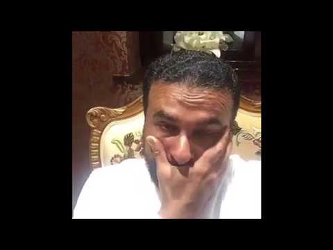 هوس نتف الشعر - علاج هوس نتف الشعر 526 2