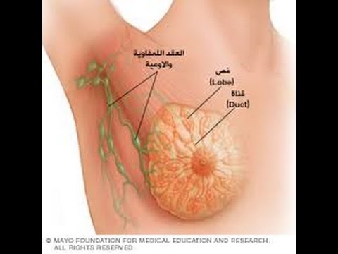 انواع سرطان الثدي , سرطانات الثدى والعلاج والوقاية منها