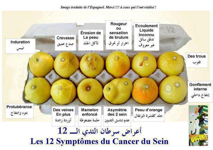 اعراض سرطان الثدي عند الفتيات بالصور - سرطان الثدي و اعراضه 2008 8