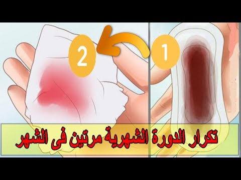 تاخر الدورة شهرين - اسباب تاخر الدورة الشهرية 324 2