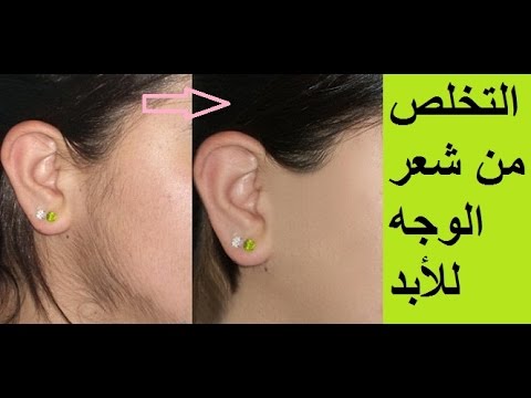 وصفات ازاله الشعر - خلطه طبيعيه لازالة الشعر الزائد من الجسم بطريقه سهله 2494 5