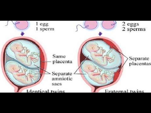 الفرق بين حركة التوائم والجنين الواحد , اعراض الحمل فى جنين واحد وفى توام