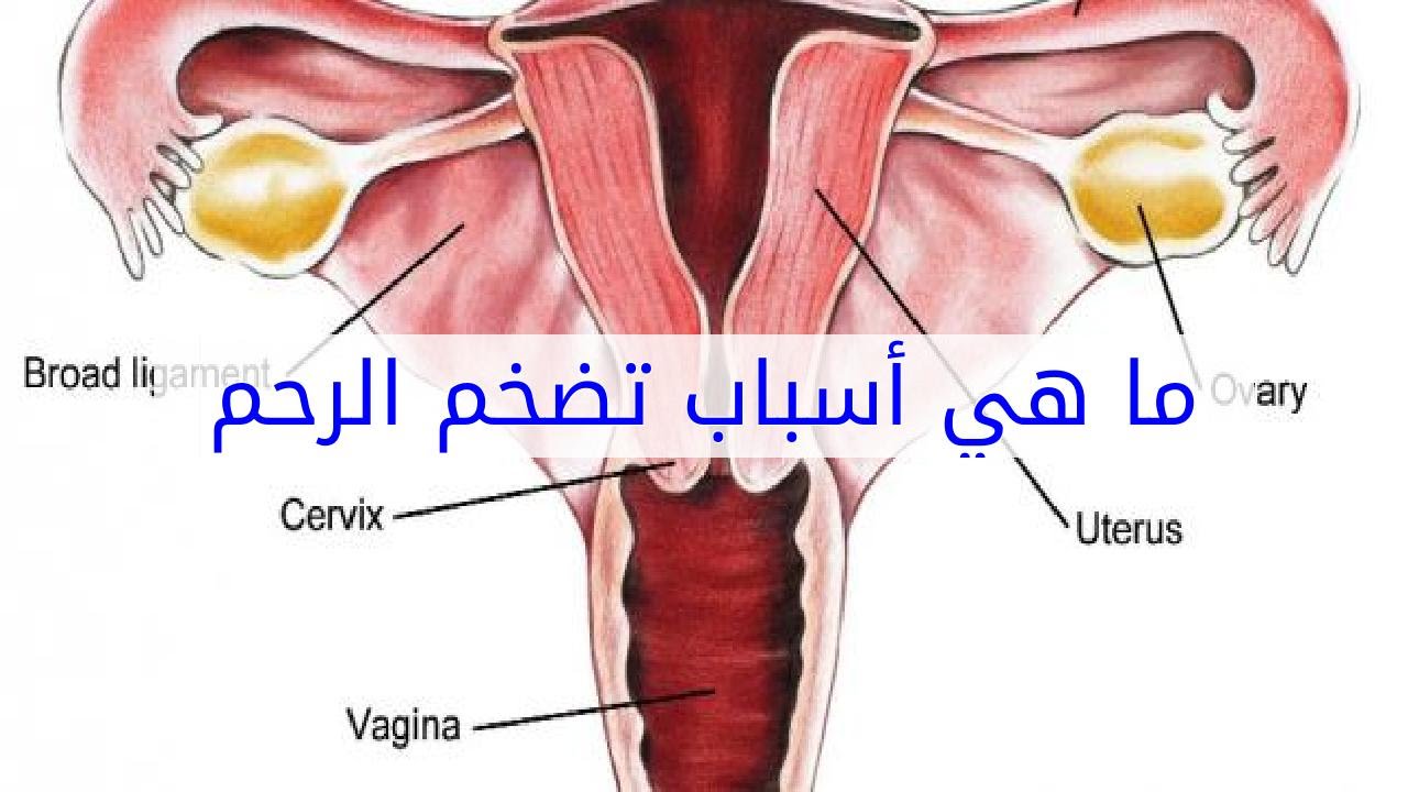 اسباب تضخم الرحم , سبب تمدد الرحم