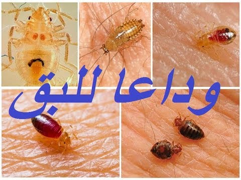 طريقة القضاء على البق نهائيا - علامات ظهور البق 4158 2