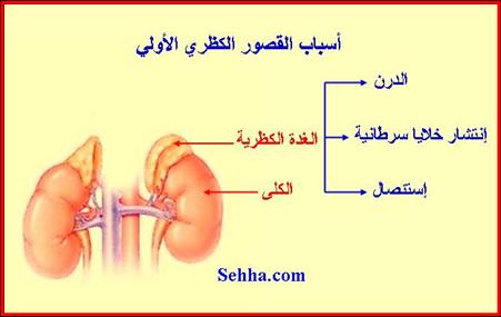 اعراض القصور الكلوي - تعرف على مسببات واعراض 4257 11